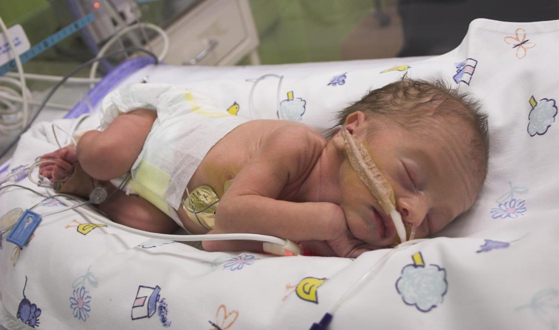 Baby in neonatal intensive care